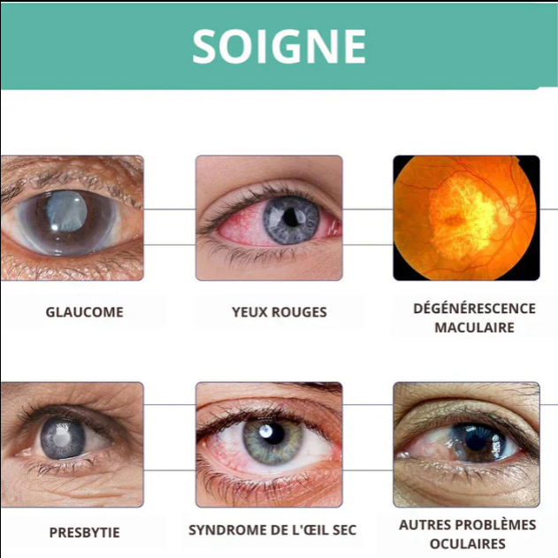 Vision Pro| Rouleau d'Amélioration de la Vision – Image 2