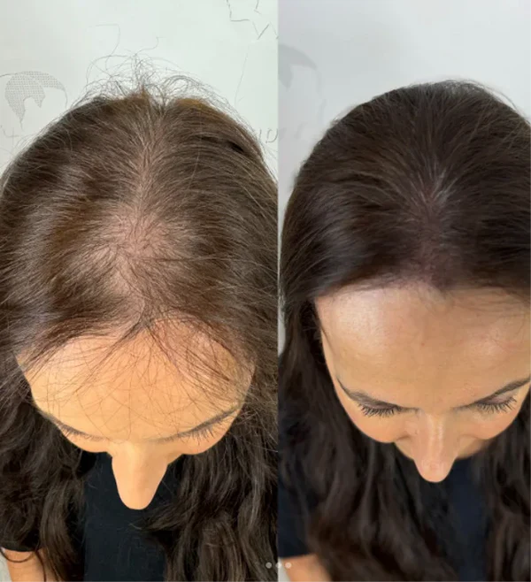 Sérum roll-on pour la croissance des cheveux