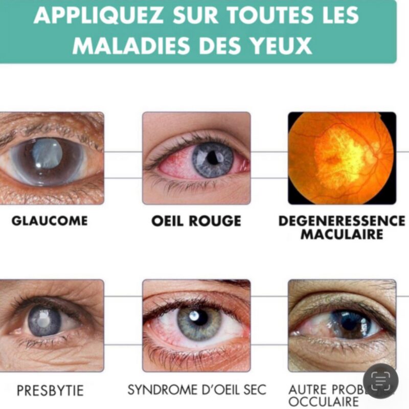 🇨🇲 ROULEAU VISION FLOUE - GUERIR TOUTES MALADIES DES YEUX 🇨🇲